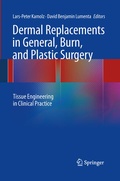Abbildung von: Dermal Replacements in General, Burn, and Plastic Surgery - Springer