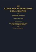 Cover: Die Klinik der Tuberkulose Erwachsener - Springer