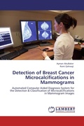 Cover: Detection of Breast Cancer Microcalcifications in Mammograms - LAP Lambert Academic Publishing