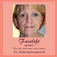 Abbildung von: Facelift operativ - BoD - Books on Demand