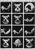 Cover: CSO - CranioSacralOsteopathie (3 Poster in Rolle) - Hippokrates