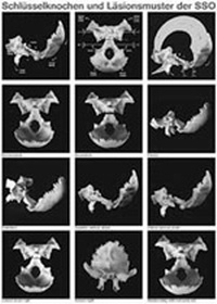 Abbildung von: CSO - CranioSacralOsteopathie (3 Poster in Rolle) - Hippokrates