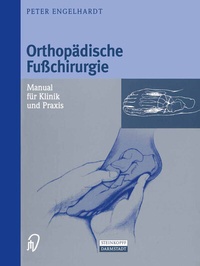 Abbildung von: Orthopädische Fußchirurgie - Steinkopff