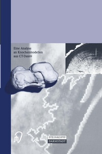 Enlarge image Cover: Die Calcaneusfraktur - Steinkopff