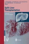 Cover: Split liver transplantation - Steinkopff
