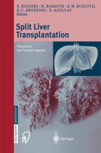 Abbildung von: Split liver transplantation - Steinkopff