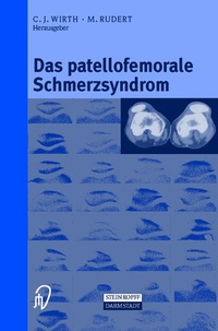 Bild vergrößern Bild: Das patellofemorale Schmerzsyndrom - Steinkopff