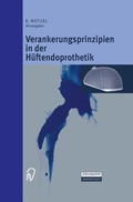 Cover: Verankerungsprinzipien in der H&uuml;ftendoprothetik - Steinkopff
