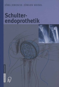Abbildung von: Schulterendoprothetik - Steinkopff