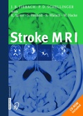 Cover: Stroke MRI - Steinkopff