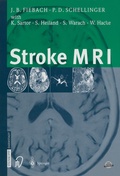 Cover: Stroke MRI - Steinkopff
