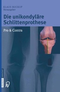 Cover: Die unikondyl&auml;re Schlittenprothese Pro & Contra - Steinkopff