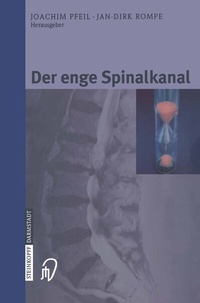 Abbildung von: Der enge Spinalkanal - Steinkopff