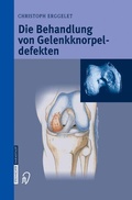 Cover: Die Behandlung von Gelenkknorpeldefekten - Steinkopff