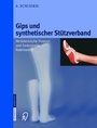 Bild: Gips und synthetischer St&uuml;tzverband - Steinkopff
