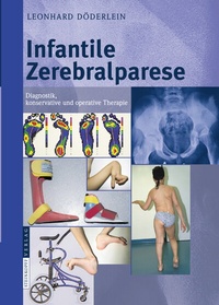 Abbildung von: Infantile Zerebralparese - Steinkopff