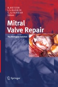 Bild: Mitral Valve Repair - Steinkopff
