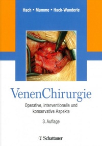 Bild vergrößern Bild: Venen Chirurgie - Schattauer
