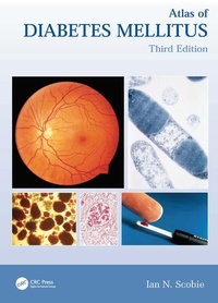 Abbildung von: Atlas of Diabetes Mellitus - CRC Press