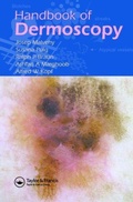 Cover: Handbook of Dermoscopy - CRC Press