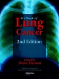 Cover: Textbook of Lung Cancer - CRC Press