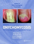 Cover: Onychomycosis - CRC Press