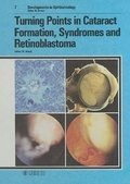 Cover: Developments in Ophthalmology / Turning Points in Cataract Formation, Syndromes and Retinoblastoma - Karger, S