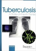 Cover: Tuberculosis - Karger, S