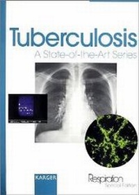 Enlarge image Cover: Tuberculosis - Karger, S