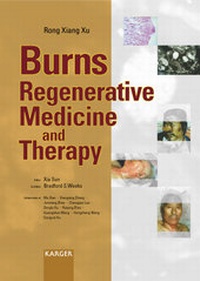 Abbildung von: Burns Regenerative Medicine and Therapy - Karger, S
