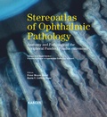 Cover: Stereoatlas of Ophthalmic Pathology - S. Karger