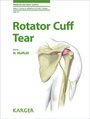 Cover: Rotator Cuff Tear - S. Karger