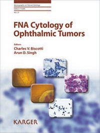 Abbildung von: FNA Cytology of Ophthalmic Tumors - S. Karger