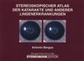 Cover: Stereoskopischer Atlas der Katarakte und anderer Linsenerkrankungen - K&ouml;nigshausen & Neumann