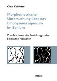Abbildung von: Morphometrische Untersuchung über das Emphysema aquosum im Senium - Tectum Wissenschaftsverlag