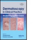 Cover: Dermatoscopy in Clinical Practice - Informa Healthcare