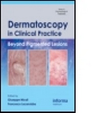 Enlarge image Cover: Dermatoscopy in Clinical Practice - Informa Healthcare