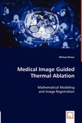Cover: Medical Image Guided Thermal Ablation - VDM Verlag Dr. Mueller E.K.