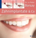 Cover: Zahnimplantate & Co. - MVS Medizinverlage Stuttgart