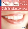 Cover: Zahnimplantate & Co. - MVS Medizinverlage Stuttgart