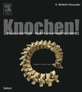 Cover: Knochen! - Spektrum Akademischer Verlag