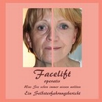 Abbildung von: Facelift operativ - BoD - Books on Demand