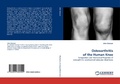 Cover: Osteoarthritis of the Human Knee - LAP Lambert Academic Publishing