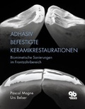 Cover: Adh&auml;siv befestigte Keramikrestaurationen - Quintessenz Verlag