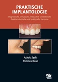 Cover: Praktische Implantologie - Quintessenz Verlag
