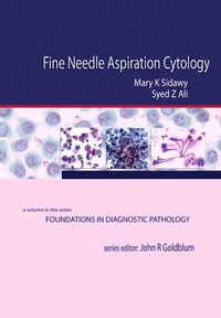 Abbildung von: Fine Needle Aspiration Cytology - Churchill Livingstone