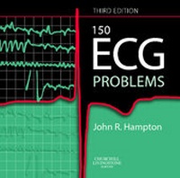Enlarge image Cover: 150 ECG Problems - Churchill Livingstone