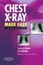 Bild: Chest X-Ray Made Easy - Churchill Livingstone