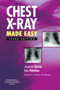 Bild vergrößern Bild: Chest X-Ray Made Easy - Churchill Livingstone