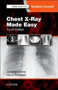 Cover: Chest X-Ray Made Easy - Elsevier